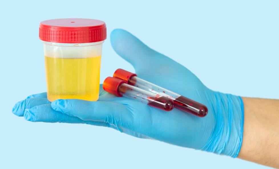 Blood In the Urine Or Stool