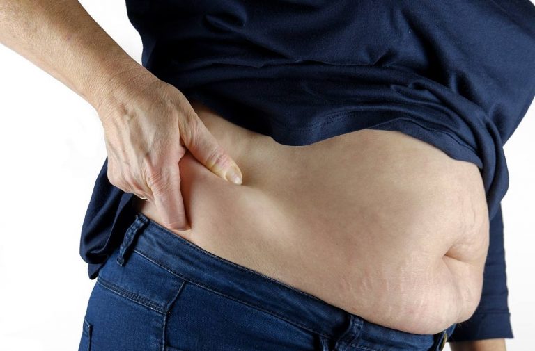 Diet, Exercise, Medication, and More: Weight Loss Approaches for Different Types of Obesity