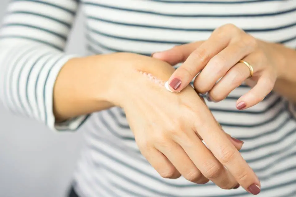 tea tree oil benefits
