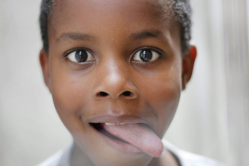 what does the white tongue mean​