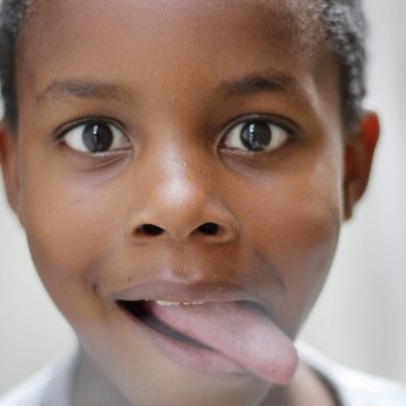 what does the white tongue mean​